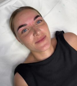 brow lamination behandeling resultaat